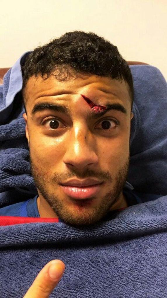Rafinha