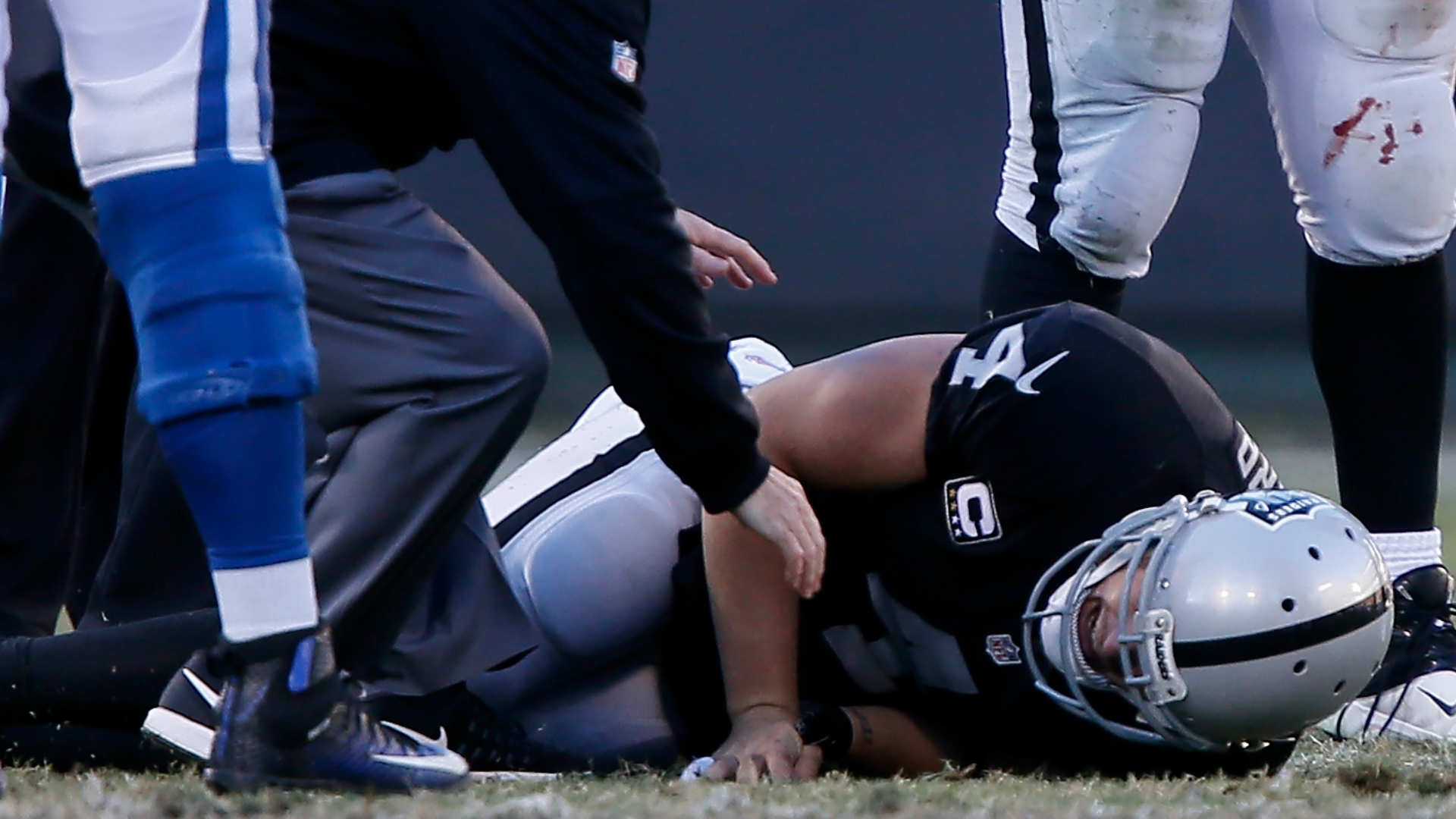 Derek Carr carted off, appears to mouth 'it's broke' grabbing right leg