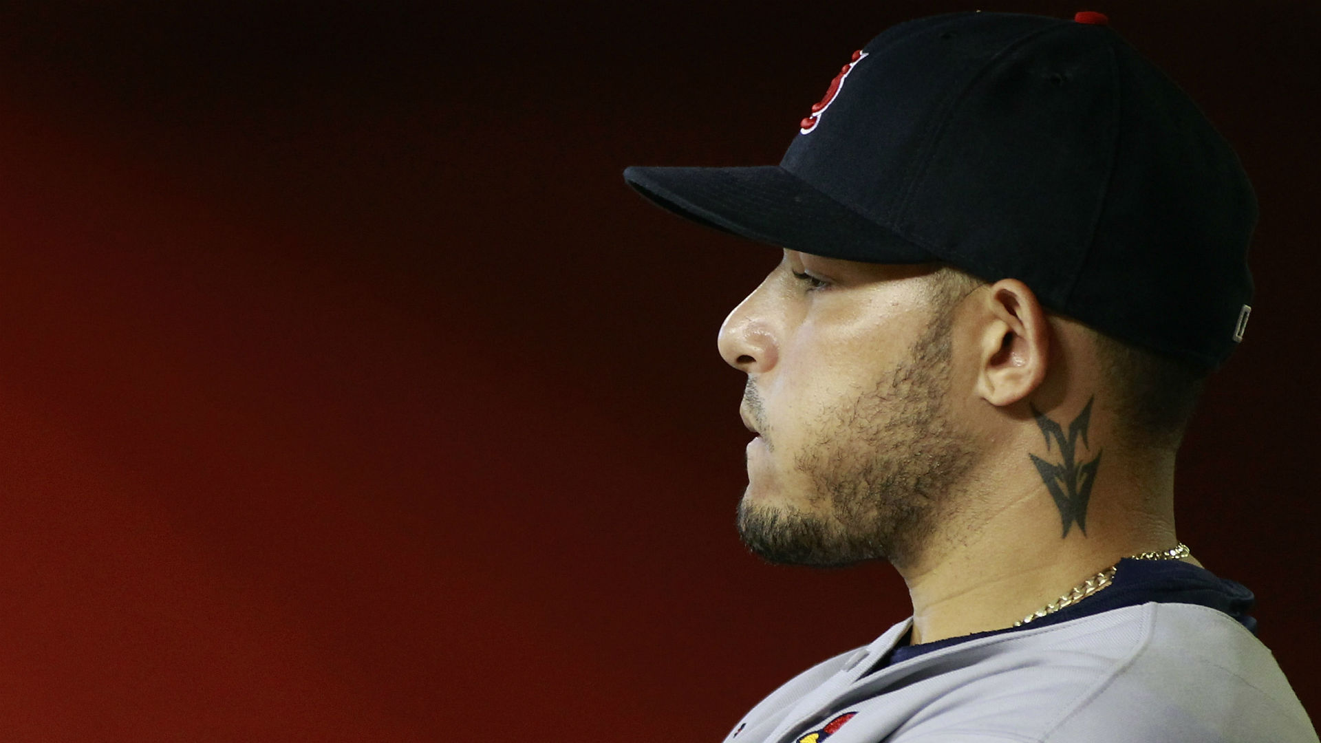 Cards' Molina has surgery, out one month