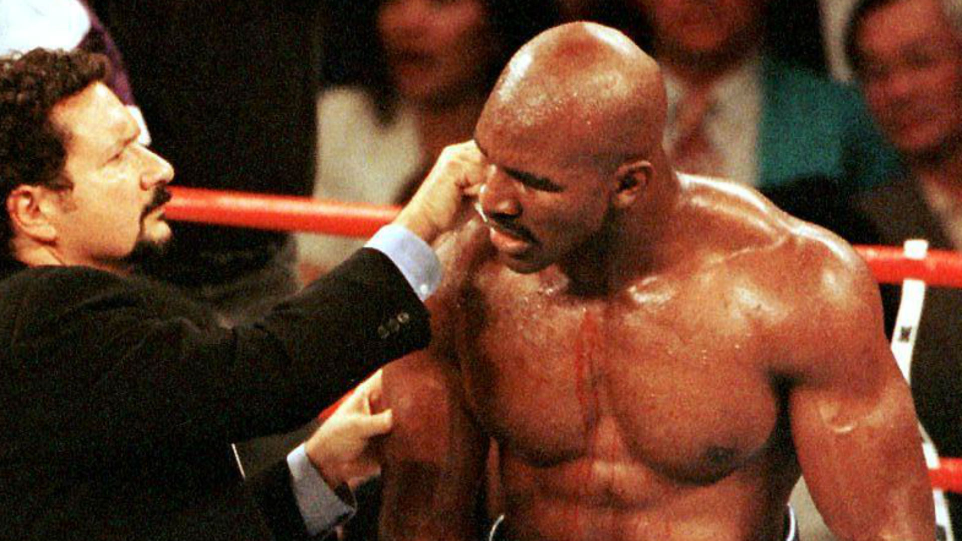 Other | What happened to Evander Holyfield's ear after 'The Bite'? He