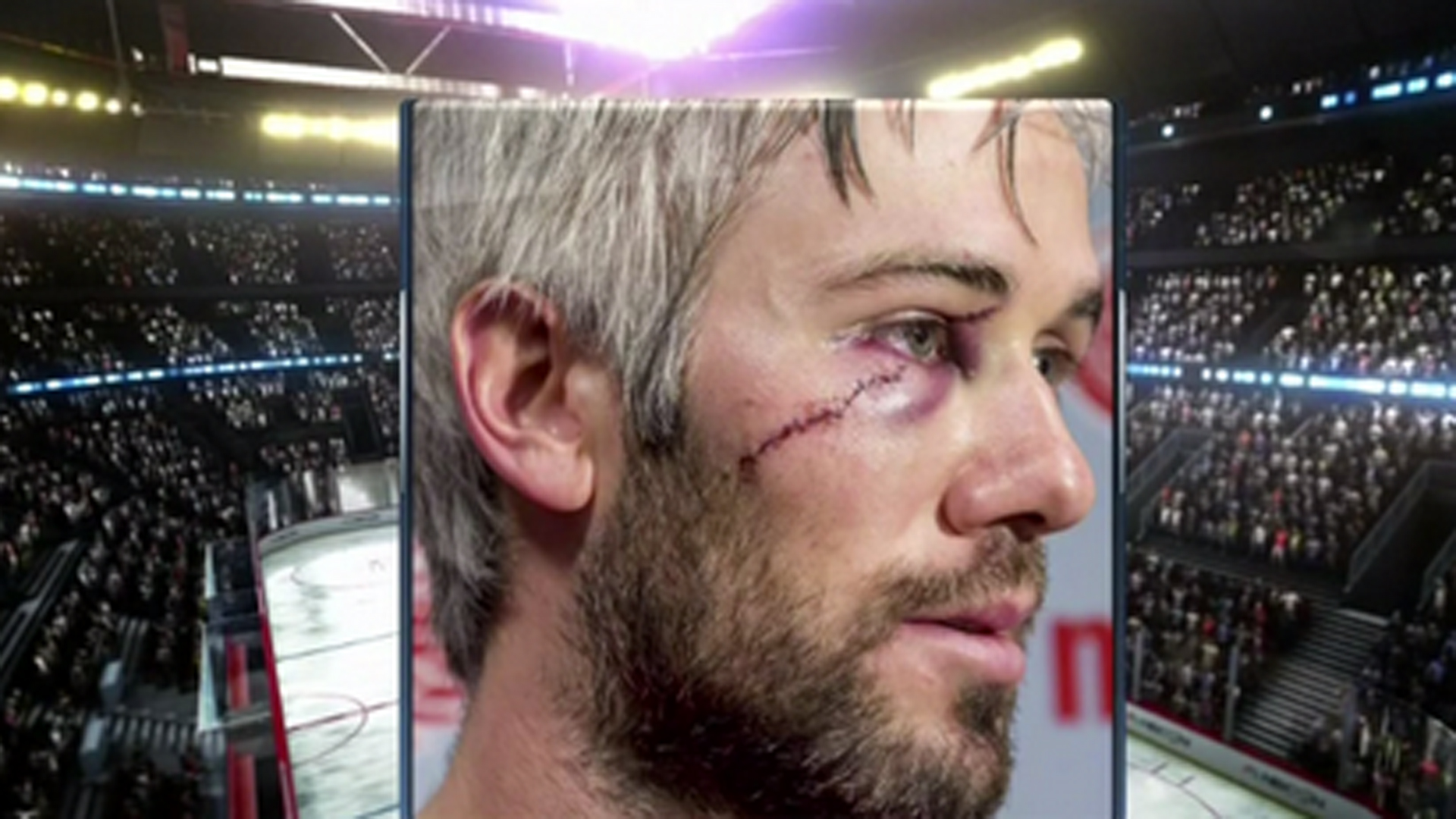 Red Wings' Drew Miller takes skate to face, wants to play next game