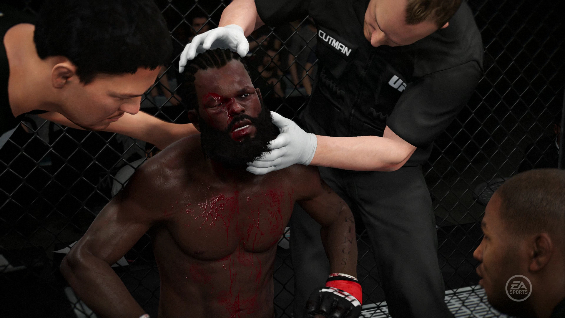 Rory MacDonald's Fight Against Stephen