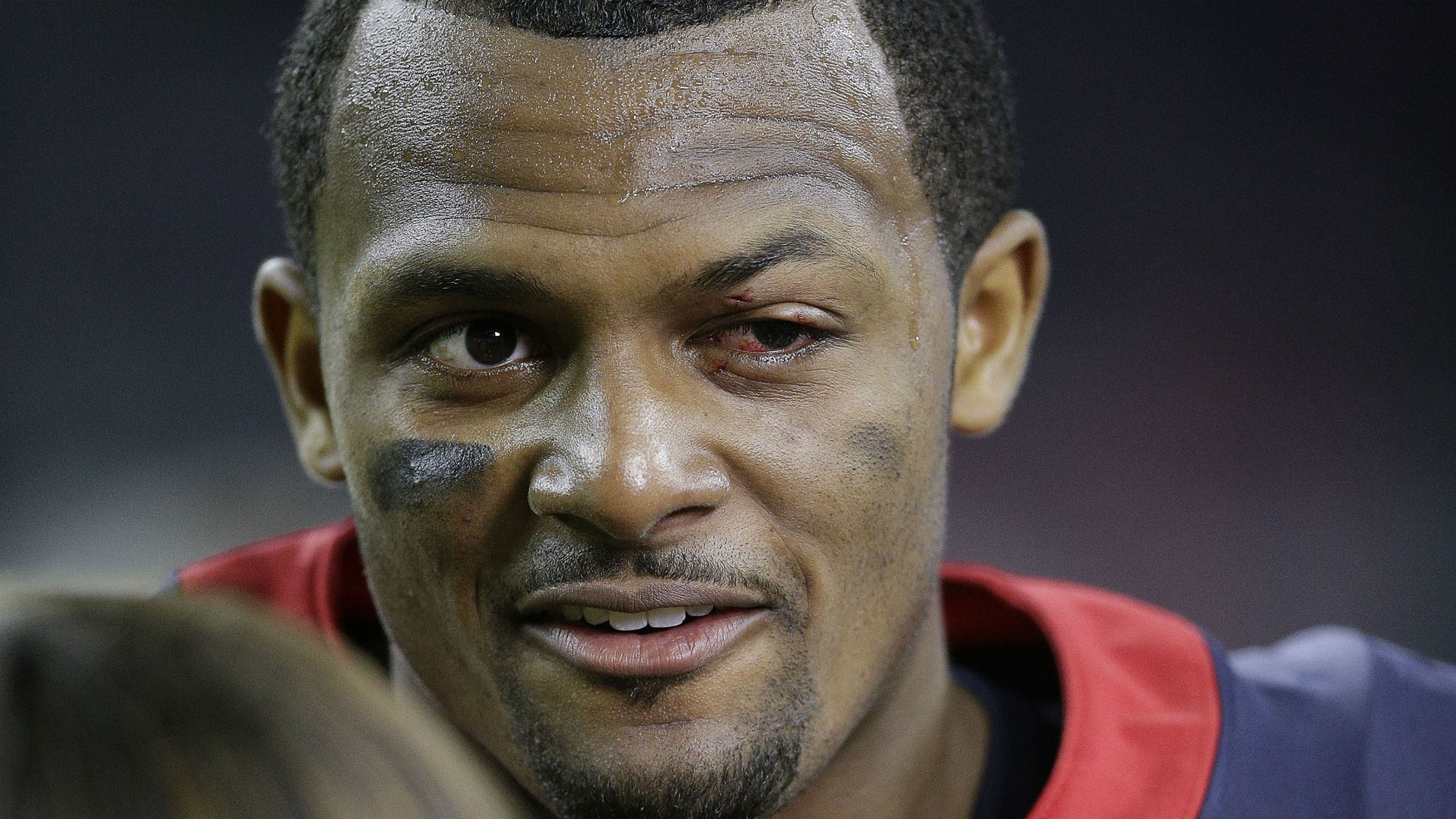 Deshaun Watson's nasty eye injury illustrates absurdity of game-winning TD: 'I kind of threw it blind'
