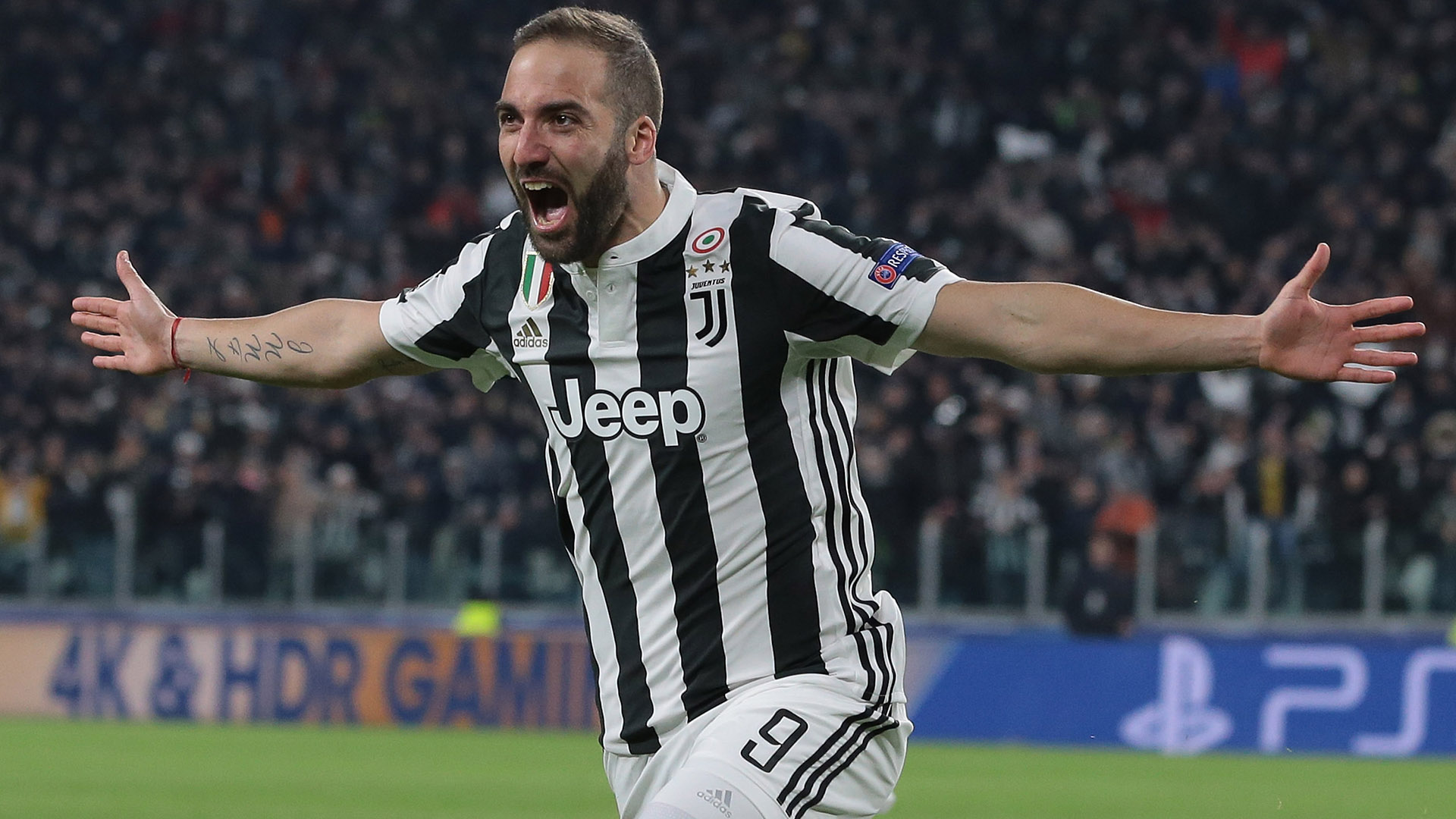 Juventus, la situazione degli infortuni di Higuaín e Bernardeschi Juventus, la situazione degli infortuni di Higuaín e Bernardeschi