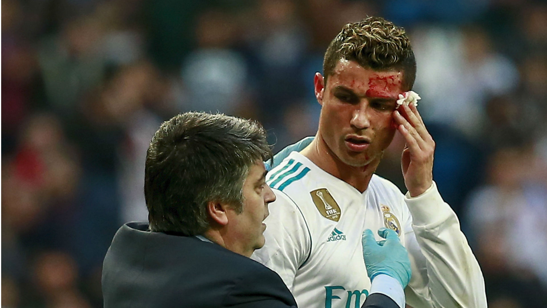Zidane defends Ronaldo for using doctor's phone to inspect face