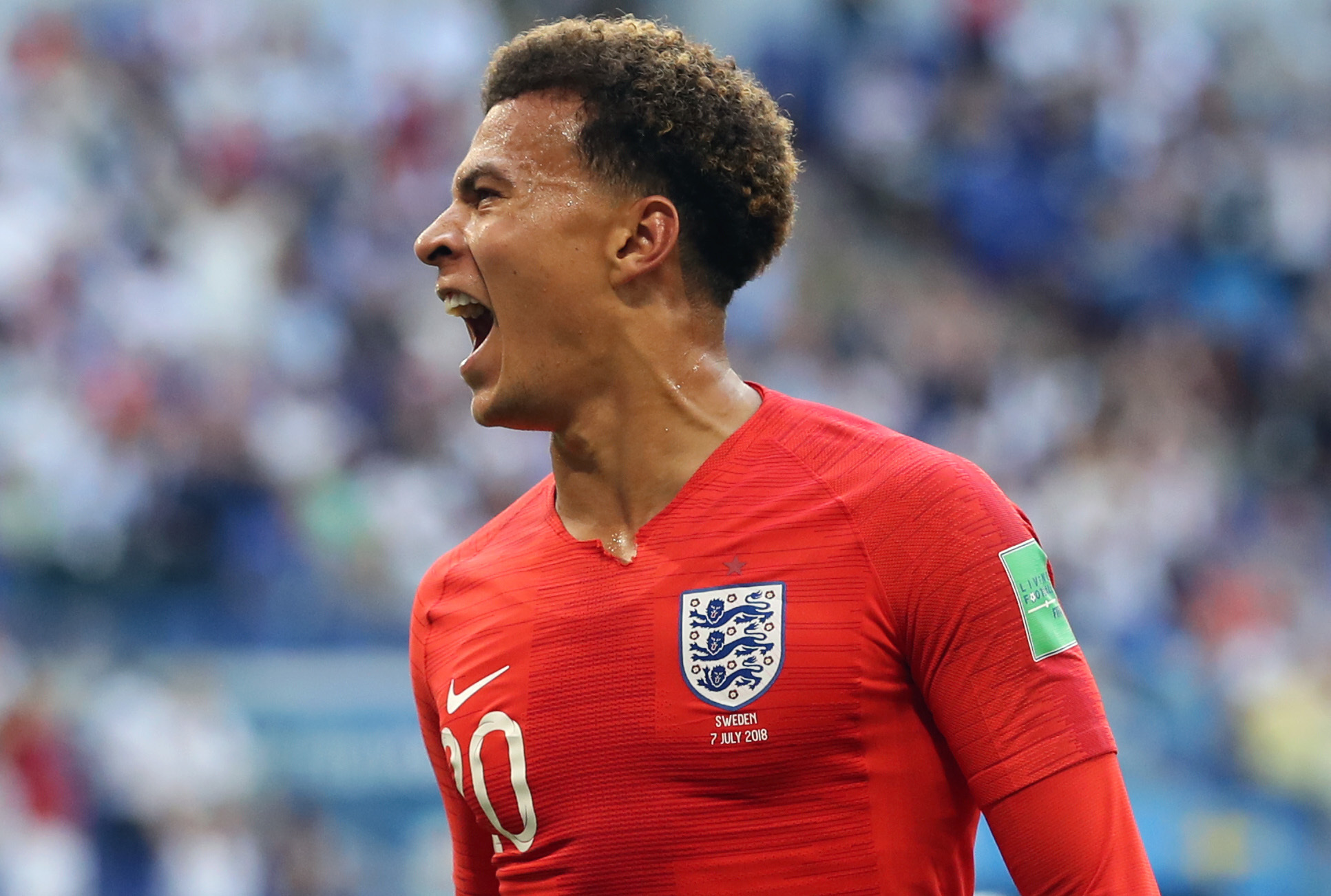 England soccer player Dele Alli was in rehab for 6 weeks after