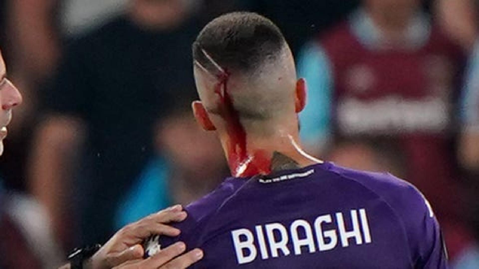 Fiorentina’s Cristiano Biraghi recieves treatment for a head injury after being struck by a plastic cup thrown from the crowd during the UEFA Europa Conference League Final at the Fortuna Arena, Prague. Picture date: Wednesday June 7, 2023.
