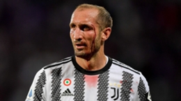 Juventus captain Giorgio Chiellini was forced off at half-time