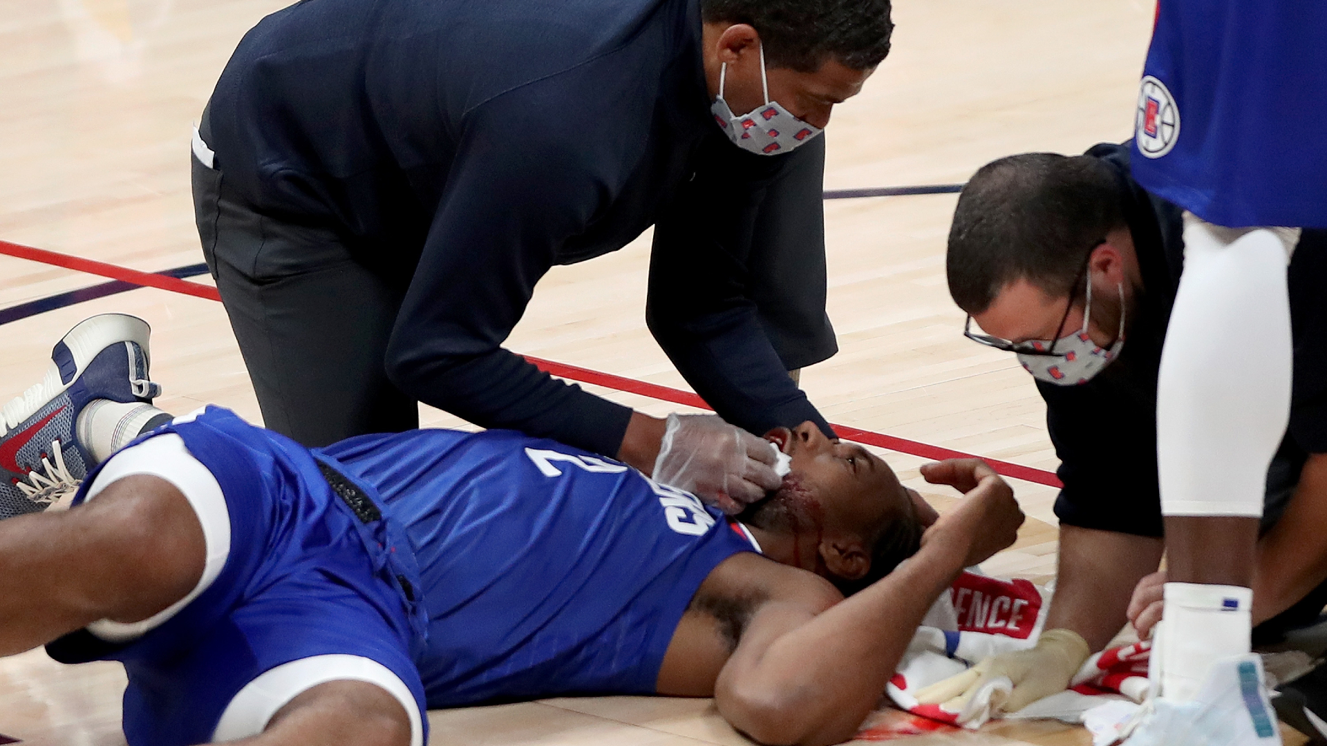 Kawhi Leonard facial injury 'was kind of scary'