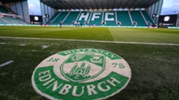 Hibernian will host a 24-hour charity football match at their training ground next month (Jane Barlow/PA)