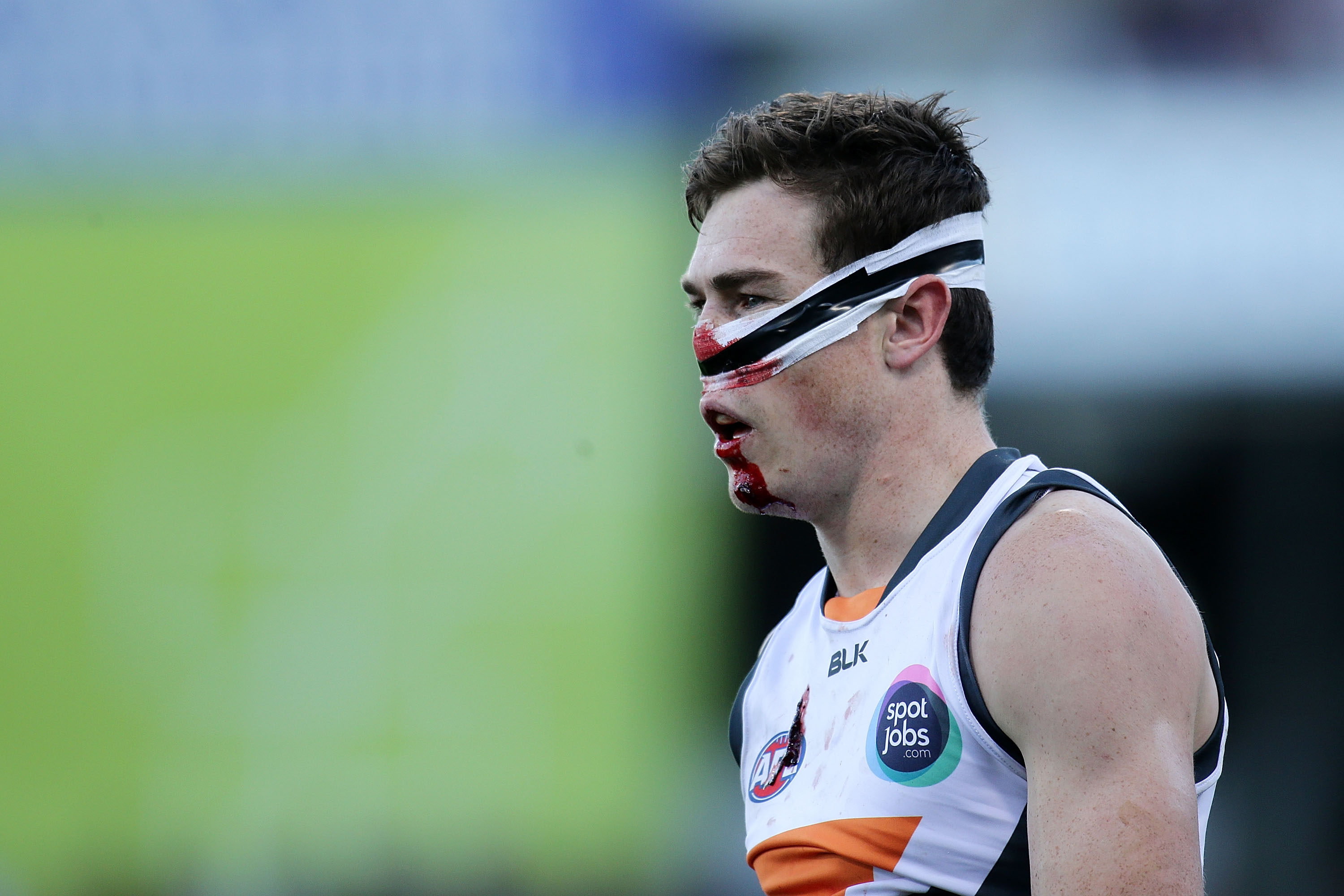 Could That Head Injury Be Causing Your Throat Pain? - 3c9yp1m