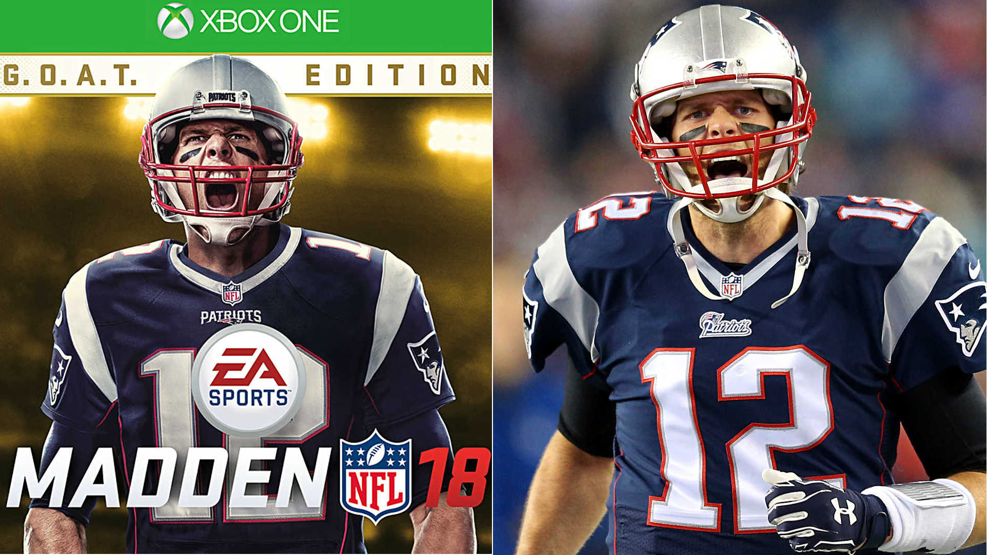 Tom Brady Madden Cover - Patriots 'Madden 18' covers: Tom Brady has his ...